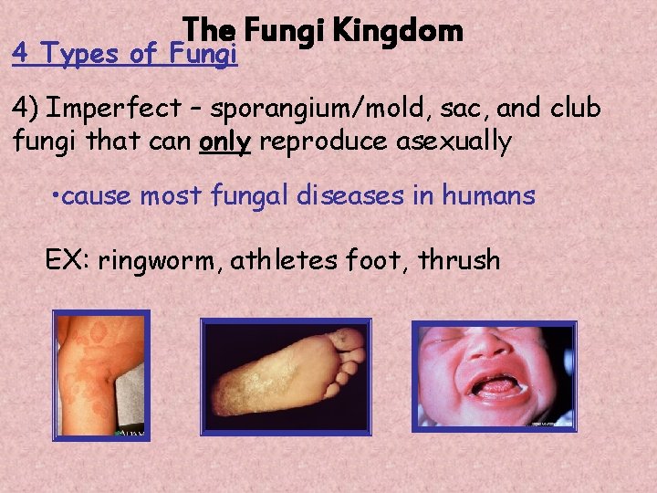 The Fungi Kingdom 4 Types of Fungi 4) Imperfect – sporangium/mold, sac, and club