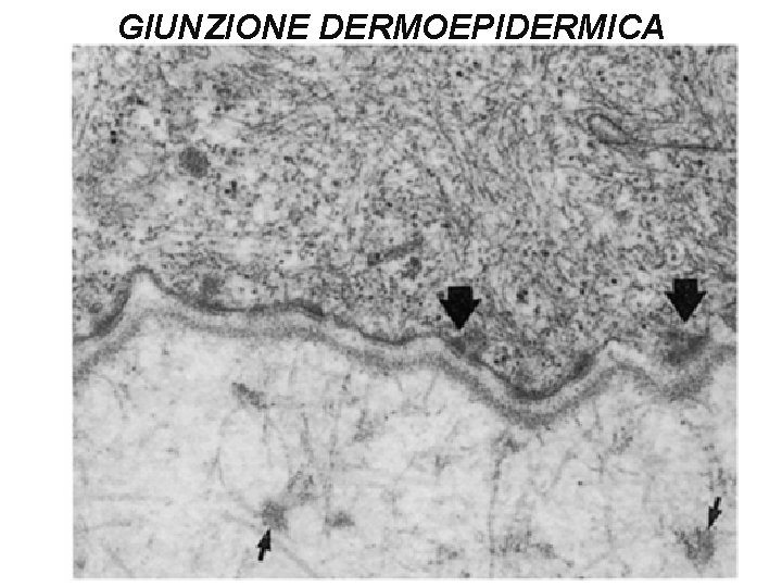 GIUNZIONE DERMOEPIDERMICA 