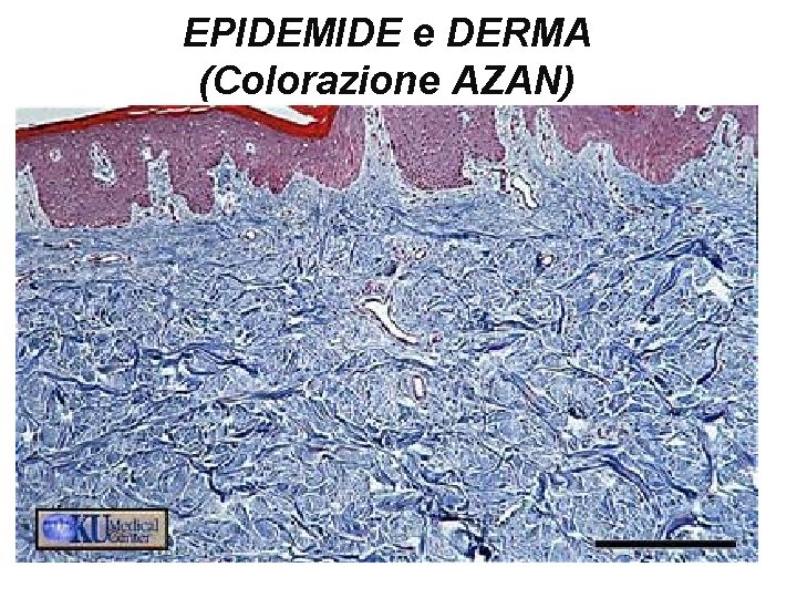 EPIDEMIDE e DERMA (Colorazione AZAN) 