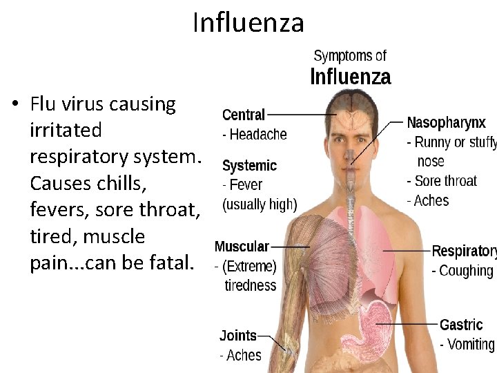 Influenza • Flu virus causing irritated respiratory system. Causes chills, fevers, sore throat, tired,