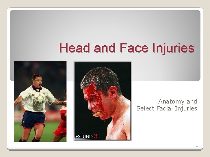 Head and Face Injuries Anatomy and Select Facial Injuries 1 