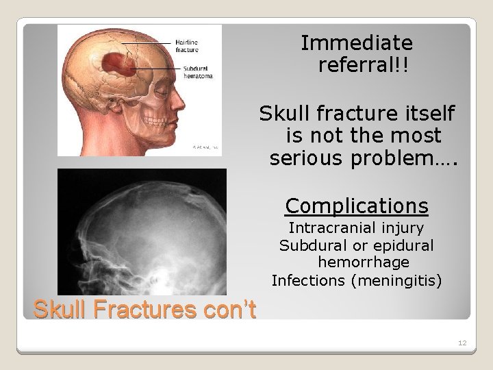 Immediate referral!! Skull fracture itself is not the most serious problem…. Complications Intracranial injury