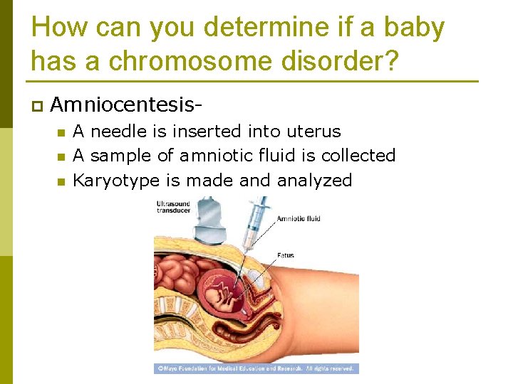 How can you determine if a baby has a chromosome disorder? p Amniocentesisn n