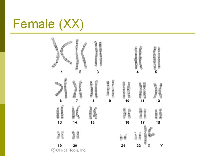 Female (XX) 