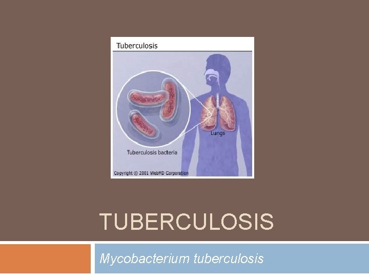 TUBERCULOSIS Mycobacterium tuberculosis TUBERCULOSIS Mycobacterium tuberculosis