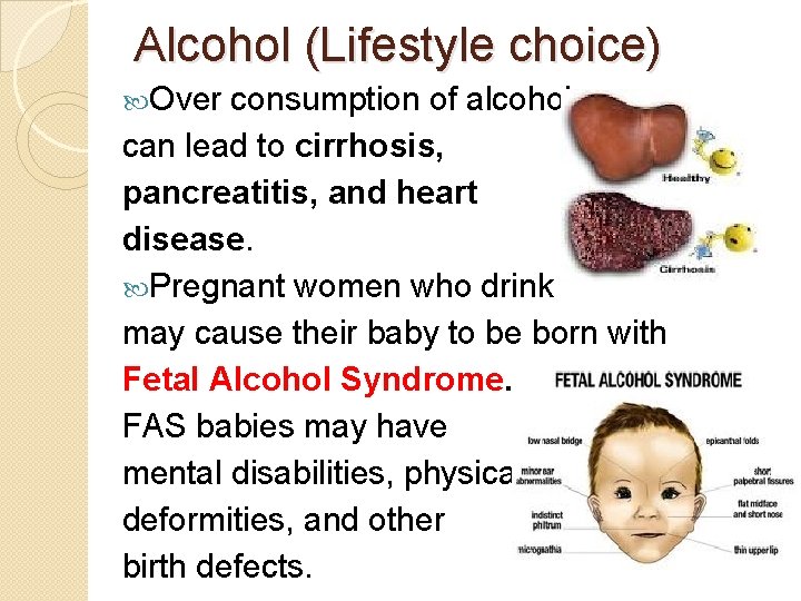 Alcohol (Lifestyle choice) Over consumption of alcohol can lead to cirrhosis, pancreatitis, and heart