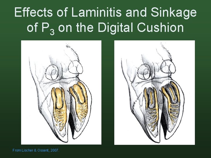 Effects of Laminitis and Sinkage of P 3 on the Digital Cushion From Lischer