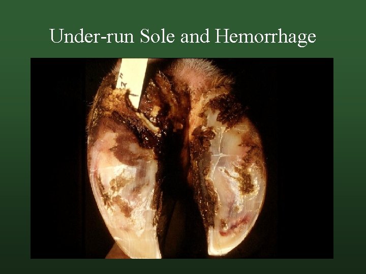Under-run Sole and Hemorrhage 