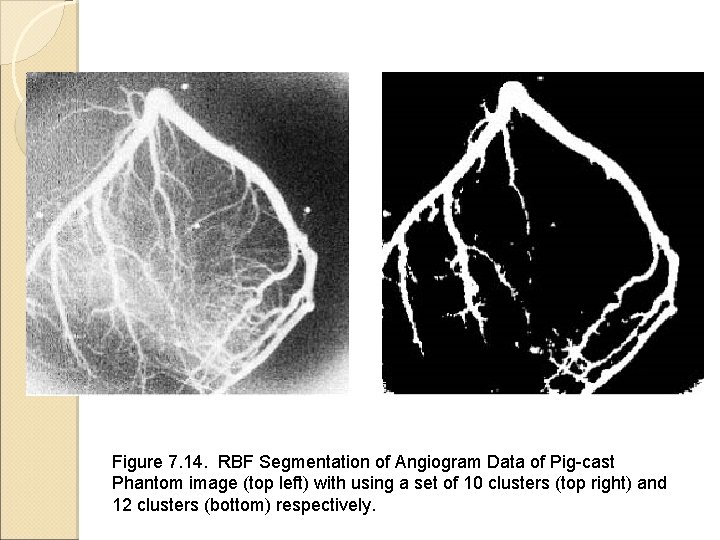 Figure 7. 14. RBF Segmentation of Angiogram Data of Pig-cast Phantom image (top left)