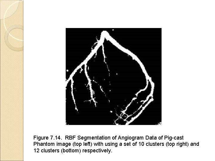 Figure 7. 14. RBF Segmentation of Angiogram Data of Pig-cast Phantom image (top left)