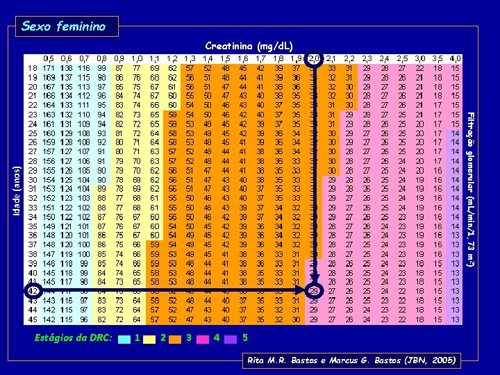 Sexo feminino Creatinina (mg/d. L) Idade (anos) Filtração glomerular (m. L/min/1, 73 m 2)