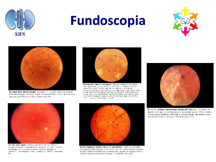 Fundoscopia 