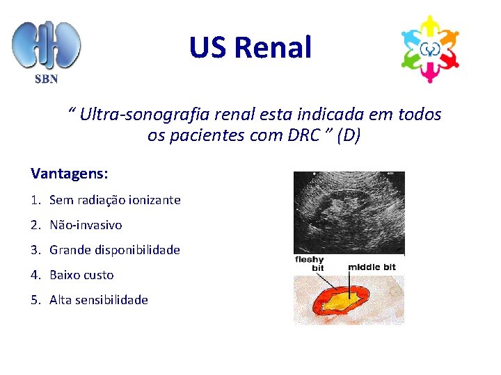 US Renal “ Ultra-sonografia renal esta indicada em todos os pacientes com DRC ”