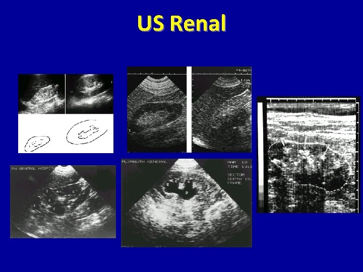 US Renal 