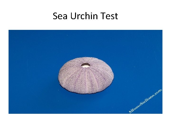 Sea Urchin Test 