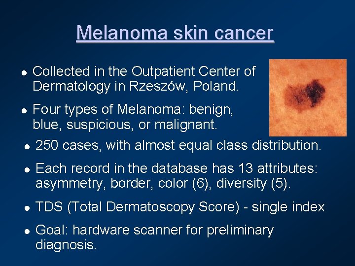 Melanoma skin cancer l l l Collected in the Outpatient Center of Dermatology in