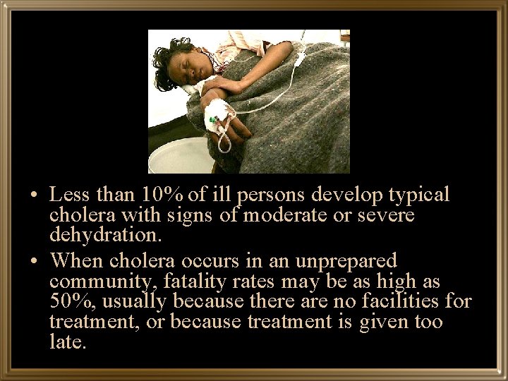  • Less than 10% of ill persons develop typical cholera with signs of