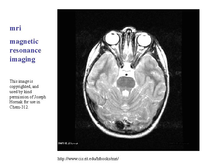 mri magnetic resonance imaging This image is copyrighted, and used by kind permission of