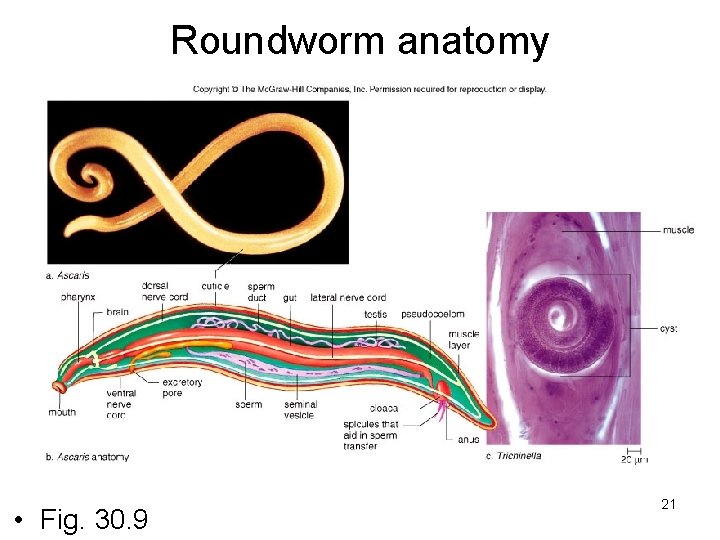 Roundworm anatomy • Fig. 30. 9 21 