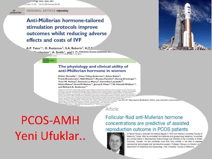 PCOS-AMH Yeni Ufuklar. . 