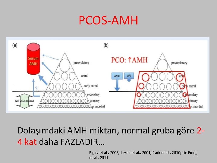 PCOS-AMH Dolaşımdaki AMH miktarı, normal gruba göre 24 kat daha FAZLADIR… Pigny et al.