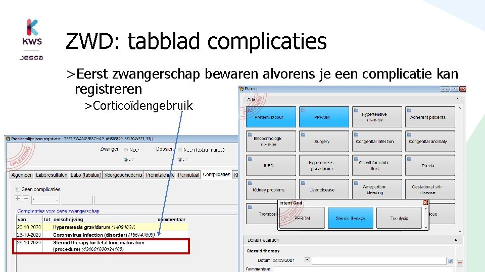 ZWD: tabblad complicaties >Eerst zwangerschap bewaren alvorens je een complicatie kan registreren >Corticoïdengebruik 