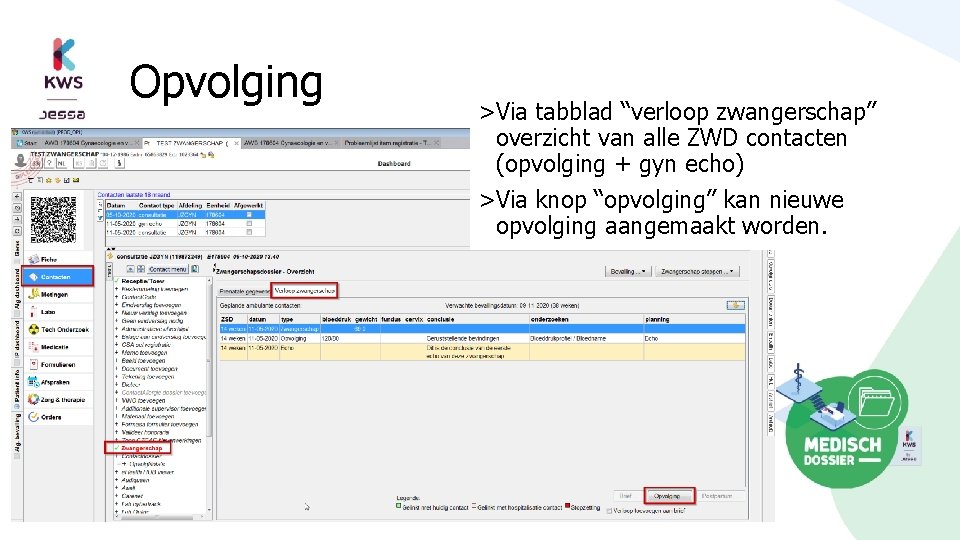 Opvolging >Via tabblad “verloop zwangerschap” overzicht van alle ZWD contacten (opvolging + gyn echo)