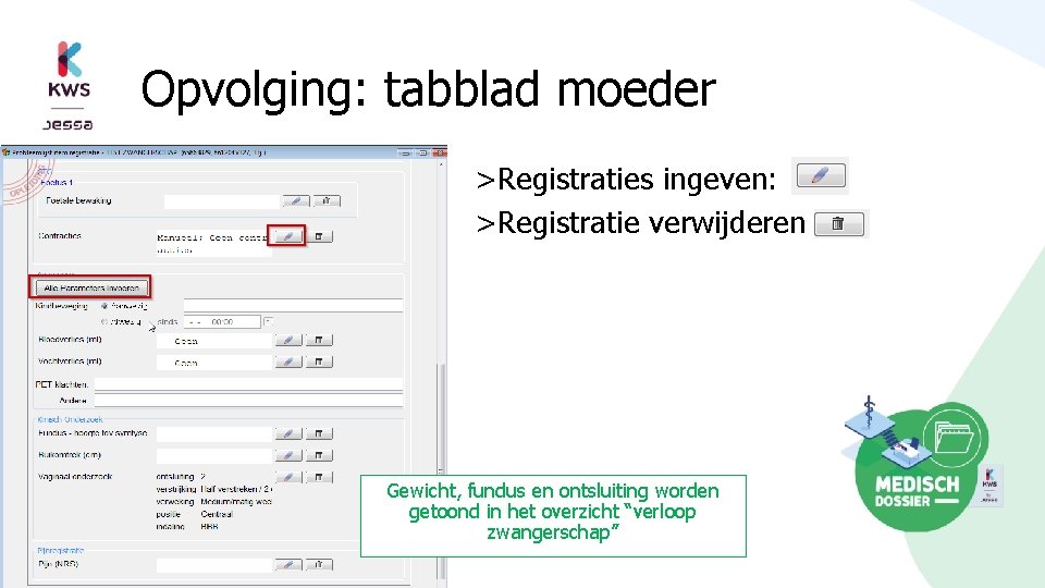 Opvolging: tabblad moeder >Registraties ingeven: >Registratie verwijderen Gewicht, fundus en ontsluiting worden getoond in