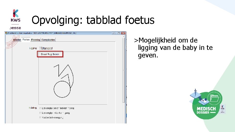 Opvolging: tabblad foetus >Mogelijkheid om de ligging van de baby in te geven. 