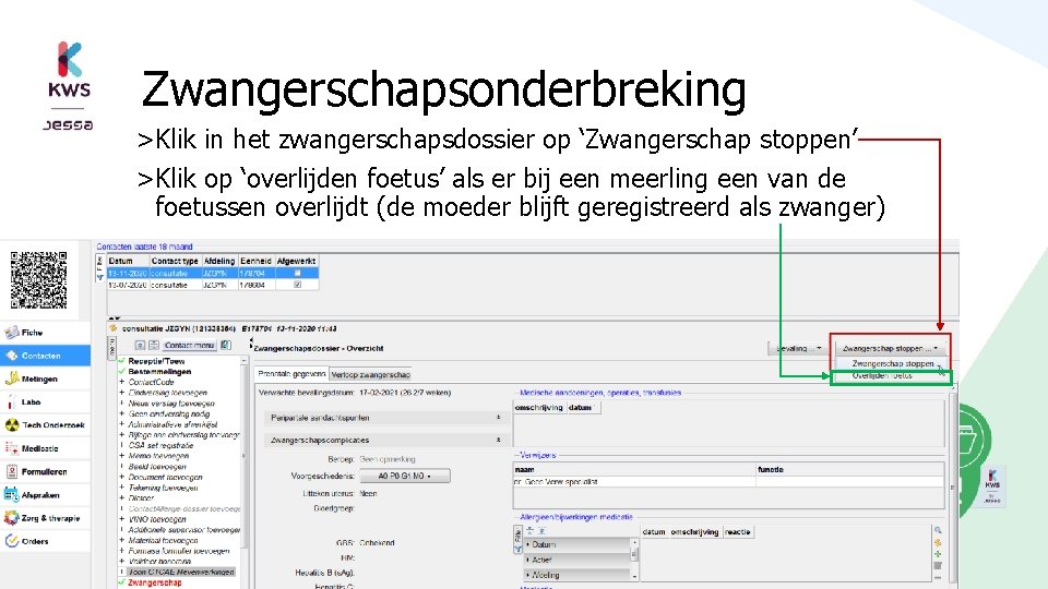 Zwangerschapsonderbreking >Klik in het zwangerschapsdossier op ‘Zwangerschap stoppen’ >Klik op ‘overlijden foetus’ als er