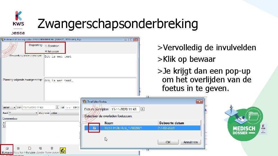 Zwangerschapsonderbreking >Vervolledig de invulvelden >Klik op bewaar >Je krijgt dan een pop-up om het