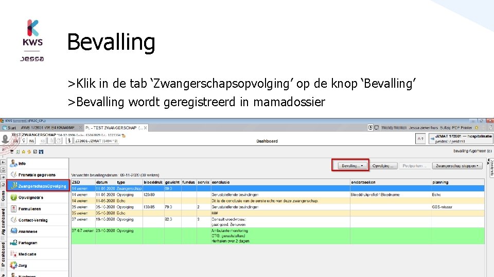 Bevalling >Klik in de tab ‘Zwangerschapsopvolging’ op de knop ‘Bevalling’ >Bevalling wordt geregistreerd in