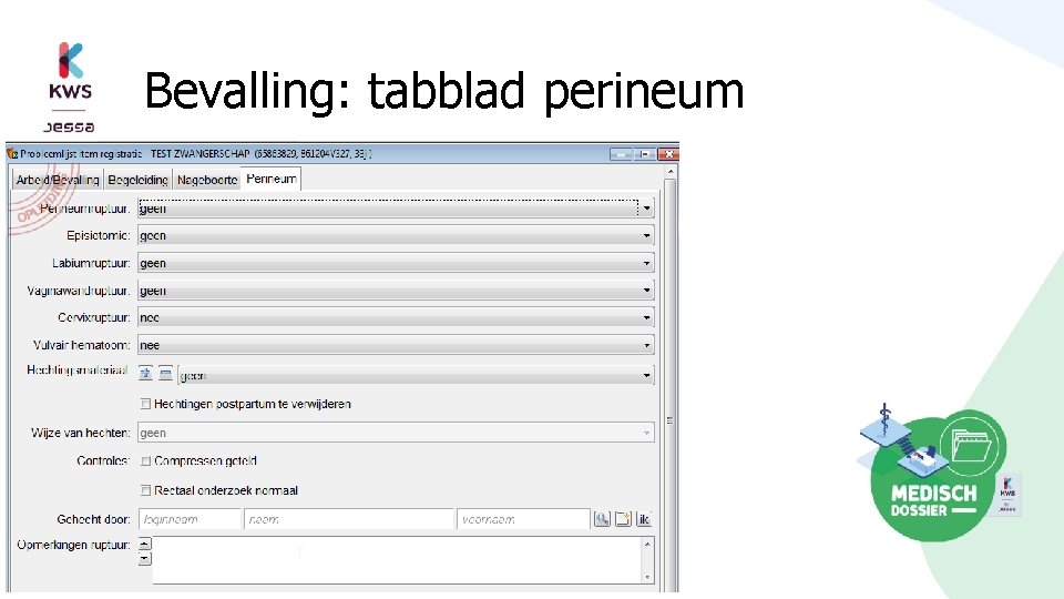 Bevalling: tabblad perineum 