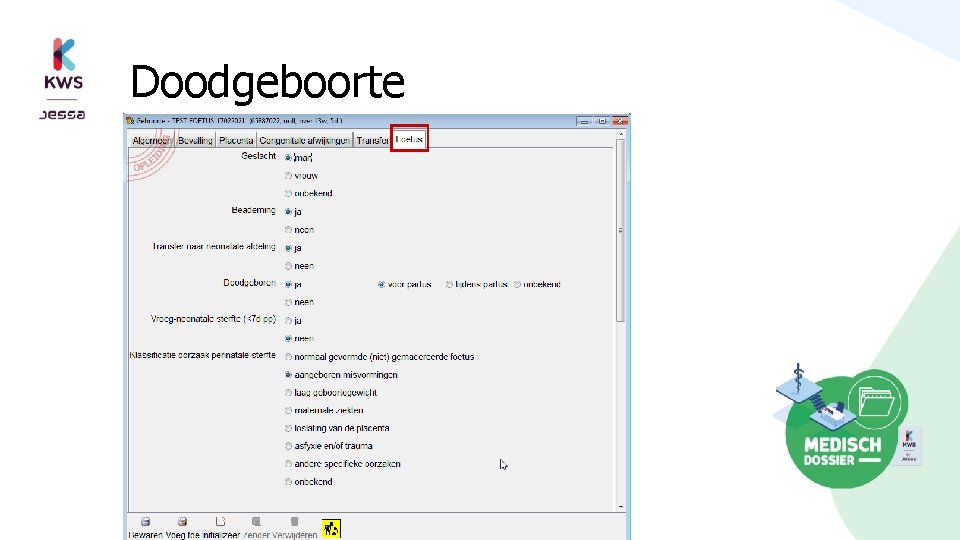 Doodgeboorte 