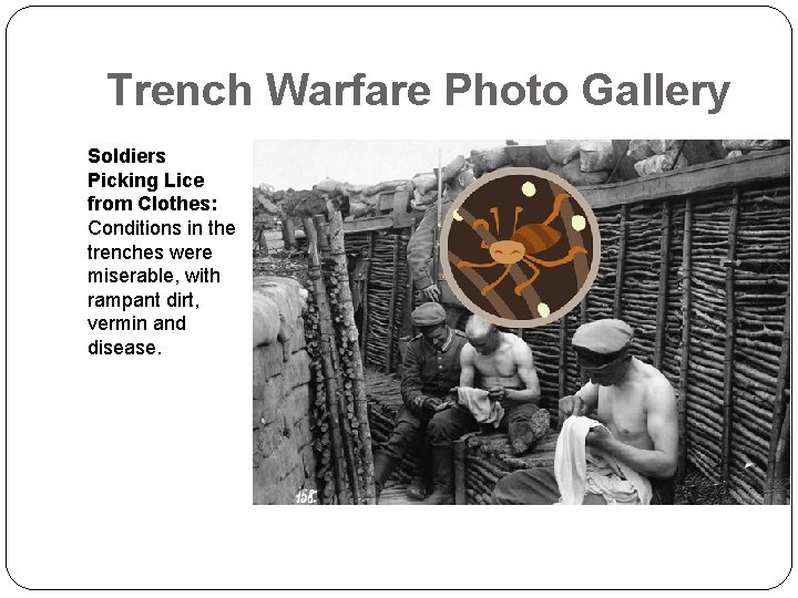 Trench Warfare Photo Gallery Soldiers Picking Lice from Clothes: Conditions in the trenches were