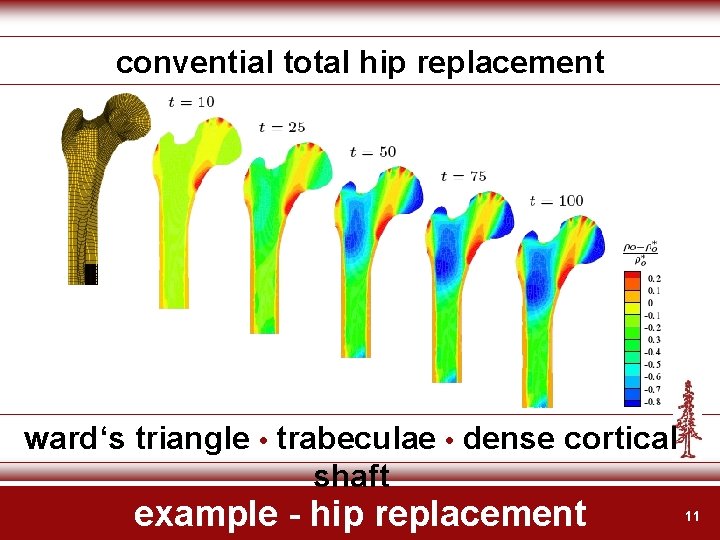 convential total hip replacement ward‘s triangle • trabeculae • dense cortical shaft example -