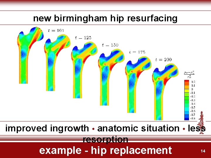 new birmingham hip resurfacing improved ingrowth • anatomic situation • less resorption example -