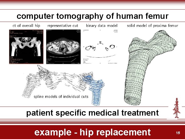 computer tomography of human femur patient specific medical treatment example - hip replacement 15