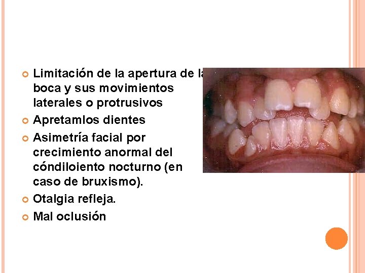 Limitación de la apertura de la boca y sus movimientos laterales o protrusivos Apretamlos