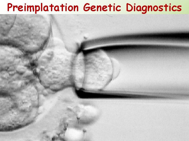 Preimplatation Genetic Diagnostics 