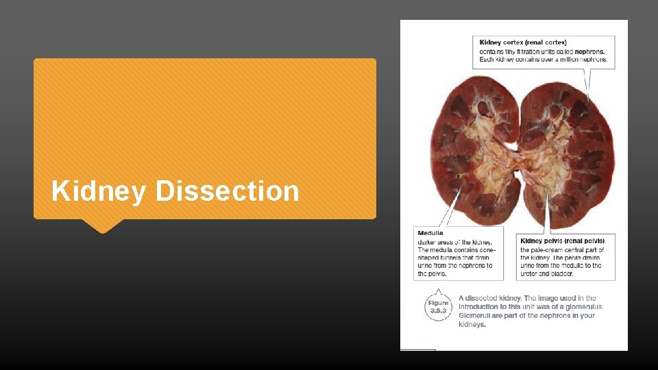 Kidney Dissection 