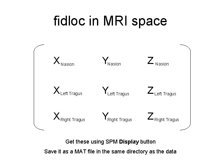 fidloc in MRI space X Nasion YNasion Z Nasion X Left Tragus YLeft Tragus fidloc in MRI space X Nasion YNasion Z Nasion X Left Tragus YLeft Tragus