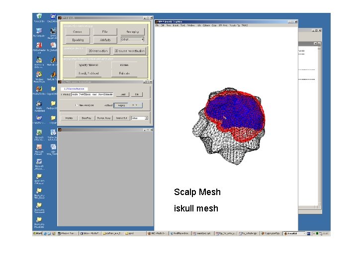 Scalp Mesh iskull mesh Scalp Mesh iskull mesh