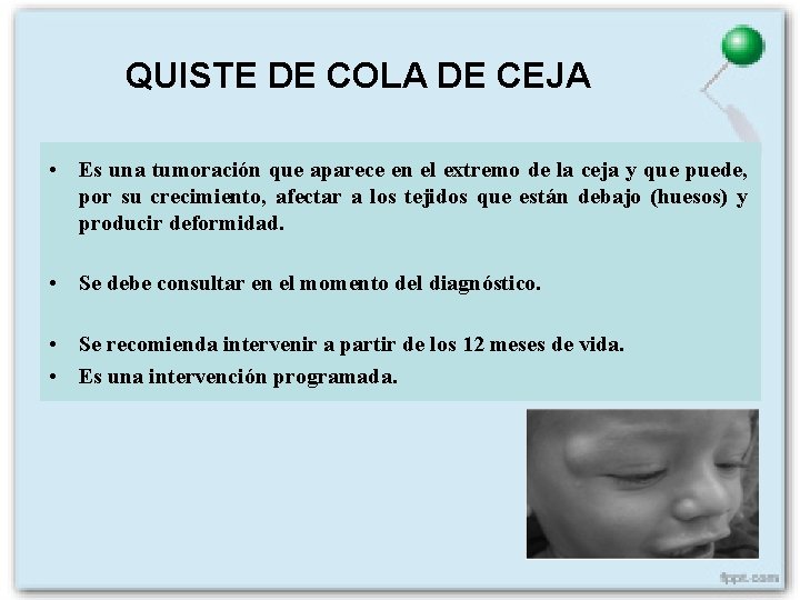 QUISTE DE COLA DE CEJA • Es una tumoración que aparece en el extremo