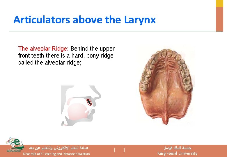 Articulators above the Larynx The alveolar Ridge: Behind the upper front teeth there is