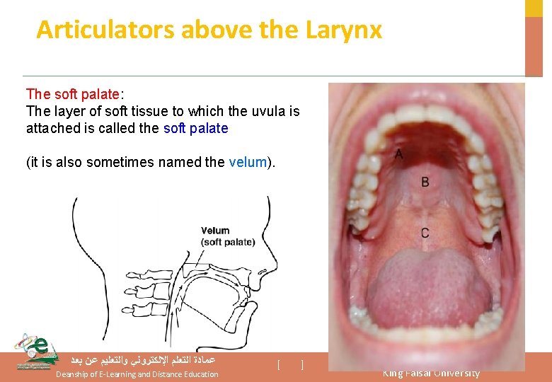 Articulators above the Larynx The soft palate: The layer of soft tissue to which