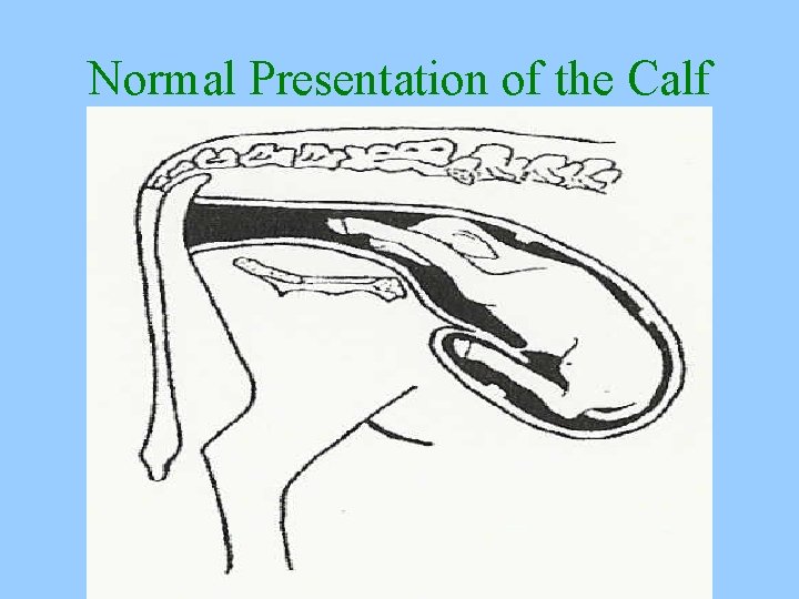 Normal Presentation of the Calf 