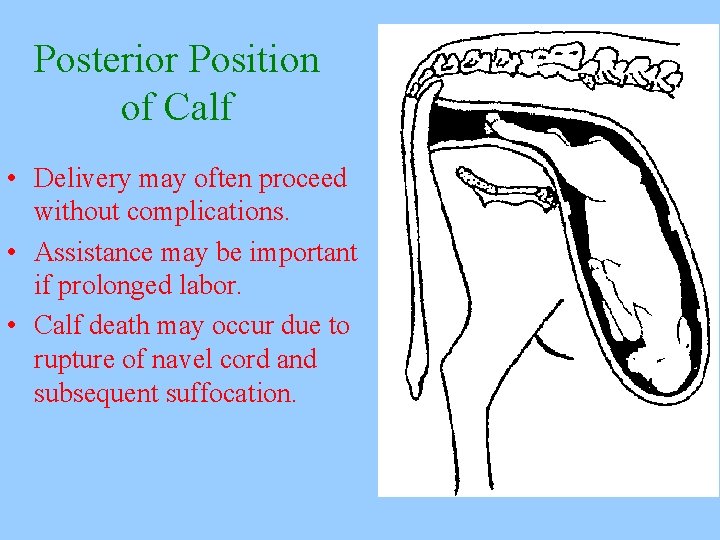 Posterior Position of Calf • Delivery may often proceed without complications. • Assistance may