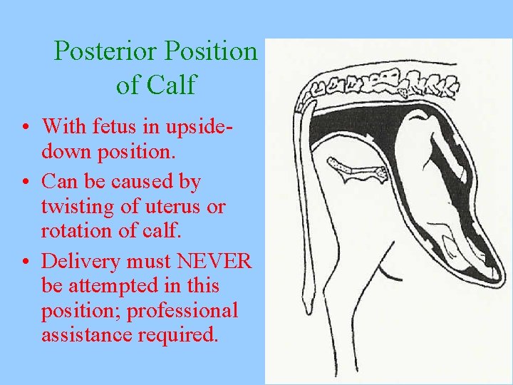 Posterior Position of Calf • With fetus in upsidedown position. • Can be caused