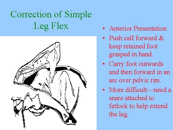 Correction of Simple Leg Flex • Anterior Presentation • Push calf forward & keep